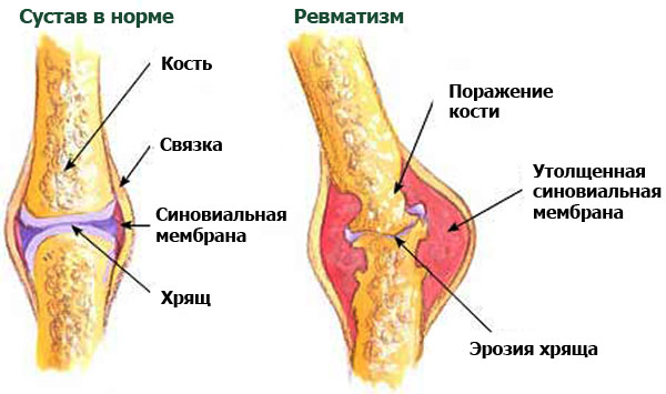 Гормоны