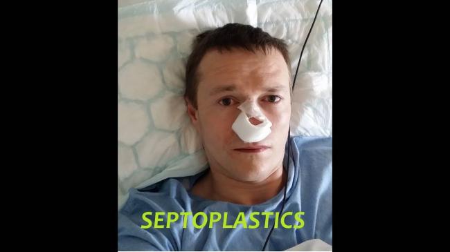 Операции по исправлению перегородки носа: хирургическая, лазером