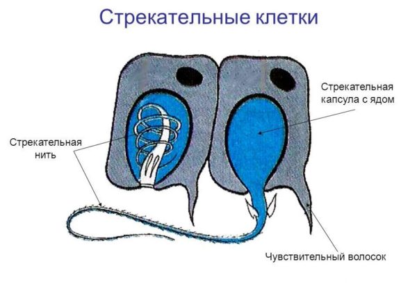 Последствия ожог медузы