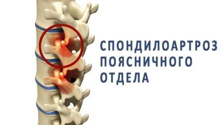 Сустагард Артро