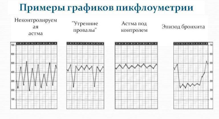 Применение эуфиллина при бронхиальной астме