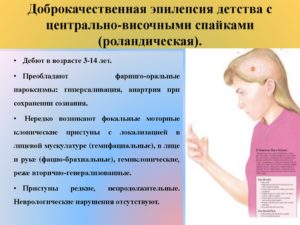 Виды эпилепсии