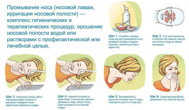 Как вылечить хронический синусит раз и навсегда