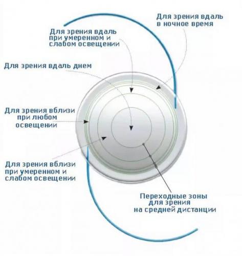 Что такое аддидация контактных линз