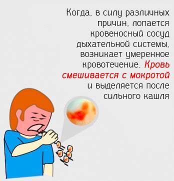 Выделяется мокрота без кашля чем лечить