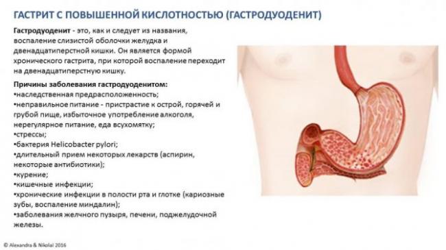Коварная бактерия хеликобактер пилори, основные симптомы и лечение хеликобактериоза