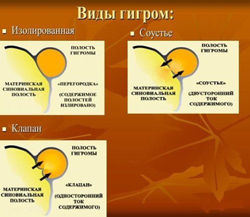 Аллергия в виде шишек на теле