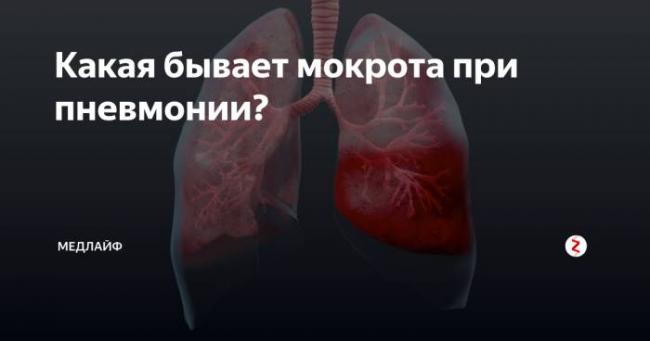 Почему при кашле появляется мокрота с кровью – связь с заболеваниями