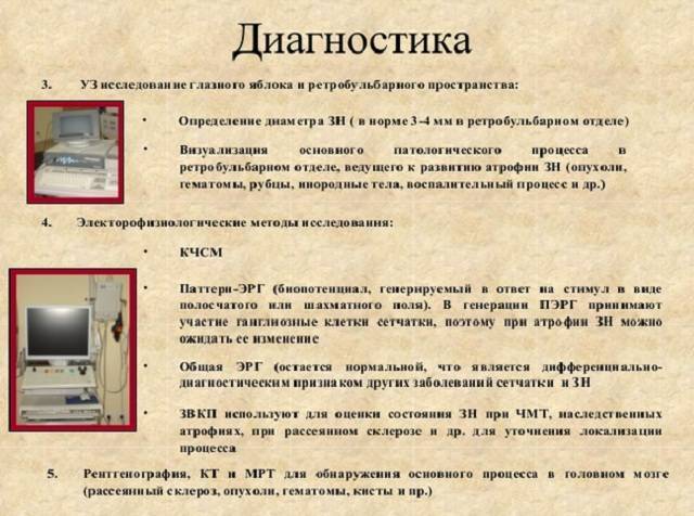 Лечение атрофии зрительного нерва народными средствами