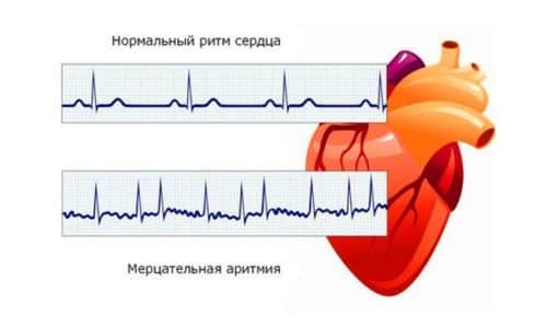 Дексаметазон: инструкция по применению уколов и для чего они нужны, цена, отзывы, аналоги