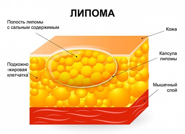 Гипомастия: маленький объем – большие проблемы, или нет?