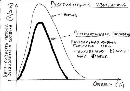Расшифровка спирограммы легких