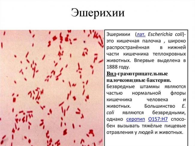 Опасно ли появление кишечной палочки в моче при беременности
