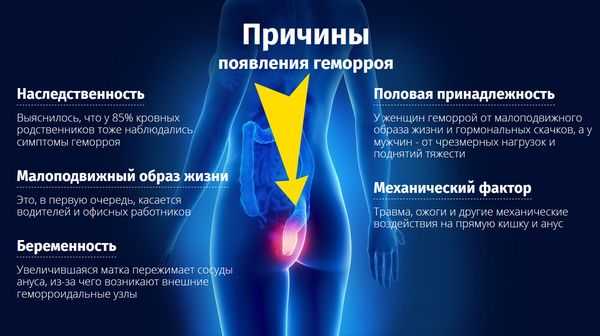 Таблетки детралекс при геморрое