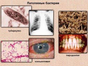 Конспект урока по социально - бытовой ориентировке на тему: инфекционные заболевания. причины возникновения и профилактика инфекционных заболеваний"