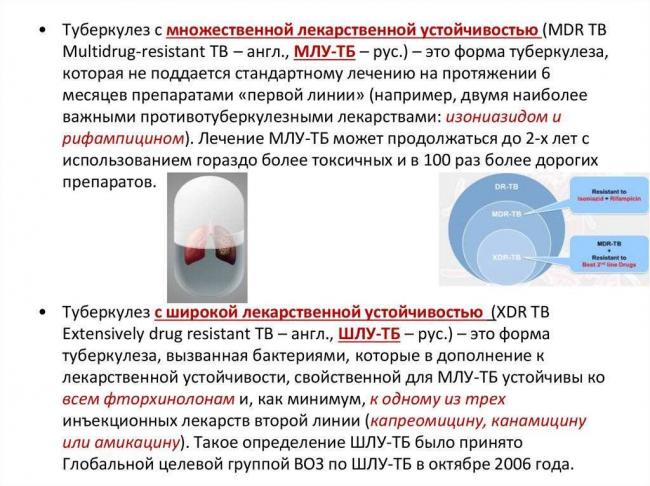 Млу туберкулез