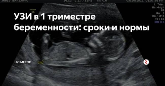 Скрининг первого триместра беременности — что нужно знать о нормах и результатах
