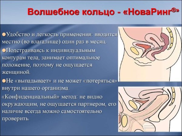 Противозачаточное кольцо новаринг - инструкция по применению