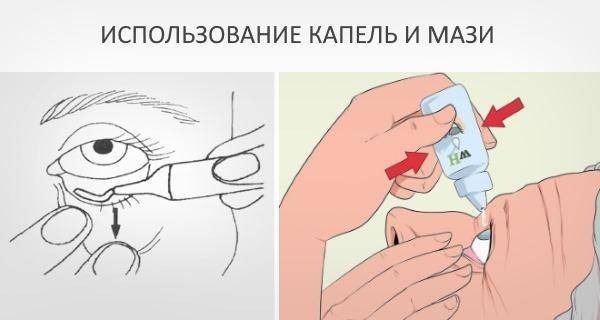 Как убрать желтизну глаз белков народными средствами