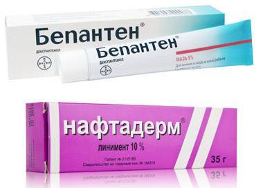 Нейродермит: симптомы и лечение 137232 11
