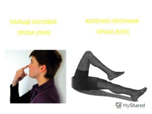 Голова: адиадохокинез