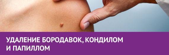 Контагиозный моллюск у детей