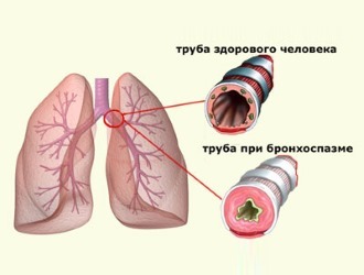 Трекрезан