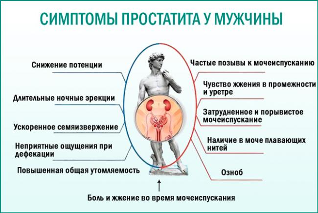 Хронические простатит у мужчин: симптомы и лечение