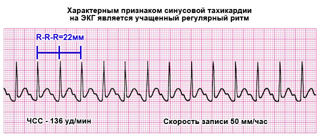 "андипал" - инструкция по применению, при каком давлении принимать, состав и отзывы
