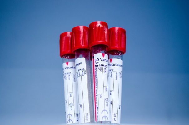 Питание по группе крови 2 диета для похудения для 1, 2, 3, 4 групп