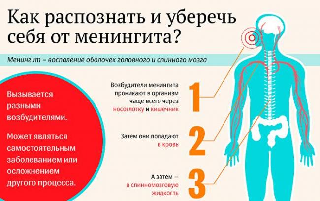 Как возникает менингит и от чего зависят разные проявления воспаления