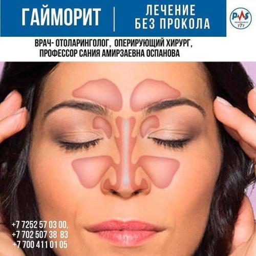 Гайморит: симптомы и лечение у взрослых