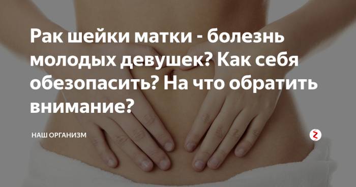 Рак шейки матки: симптомы, стадии рака, лечение, прогноз операции