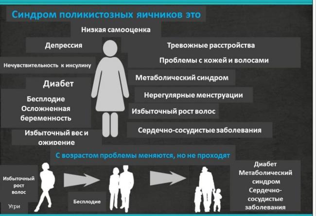 Поликистоз яичников