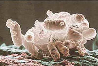 Как избавиться от e. coli в анализе мочи: лечение антибиотиками и народными средствами