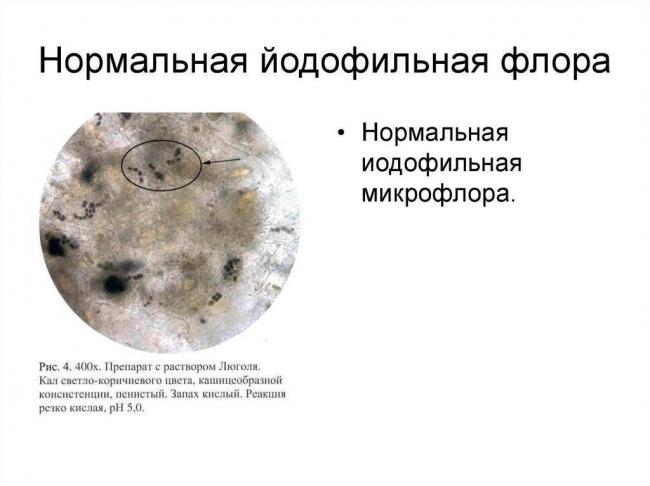 Йодофильная флора, как с ней бороться? - йодофильная флора в кале у ребенка - запись пользователя shcoda (id774321) в сообществе живем по-комаровскому в категории вопросик к мамочкам - babyblog.ru