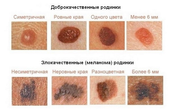 Почему возникают красные уплотнения на коже