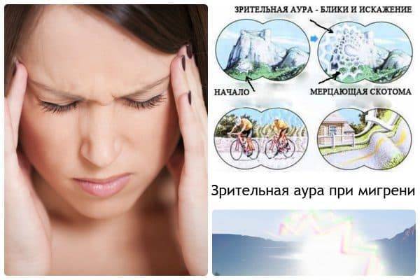 Глазная мигрень или мерцательная скотома: в чем причина и как лечить