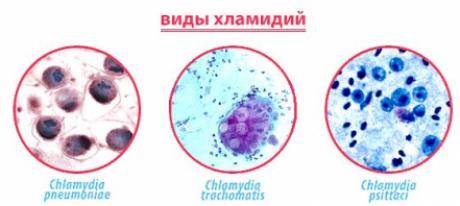 Общая характеристика наиболее опасных клостридиозов жвачных