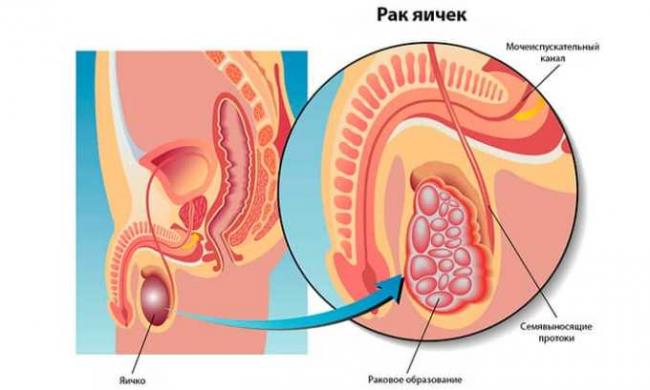 Доксорубицин-эбеве (doxorubicin-ebewe) инструкция по применению