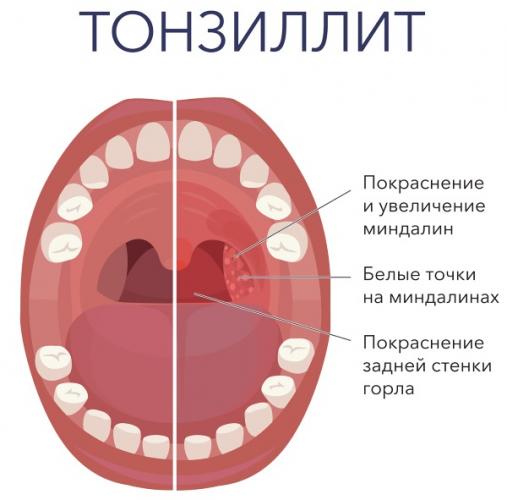 Умкалор - инструкция по применению