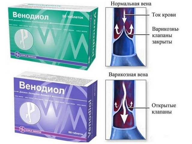 Венодиол: таблетки для лечения и профилактики варикоза
