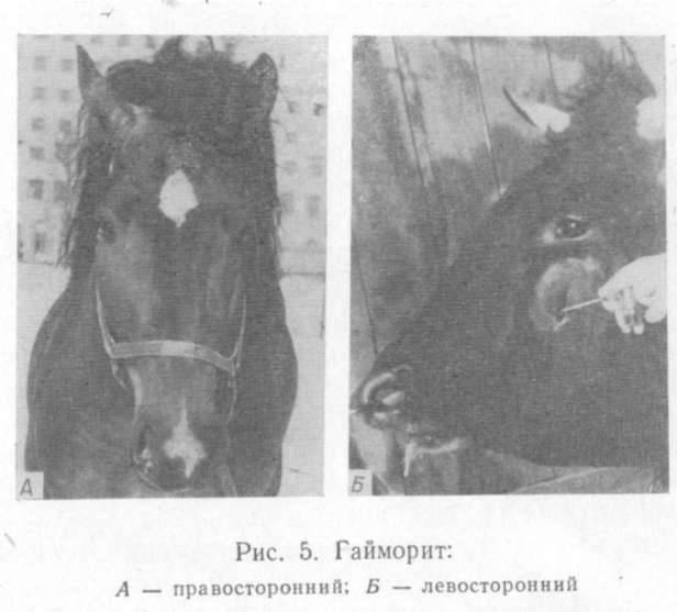 Симптомы и лечение фронтита: почему болит лобная пазуха. фронтит — причины, симптомы и лечение фронтита у взрослых