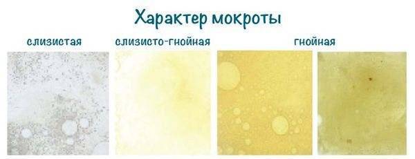 Откашливается зеленая мокрота: что делать? причины и методы лечения
