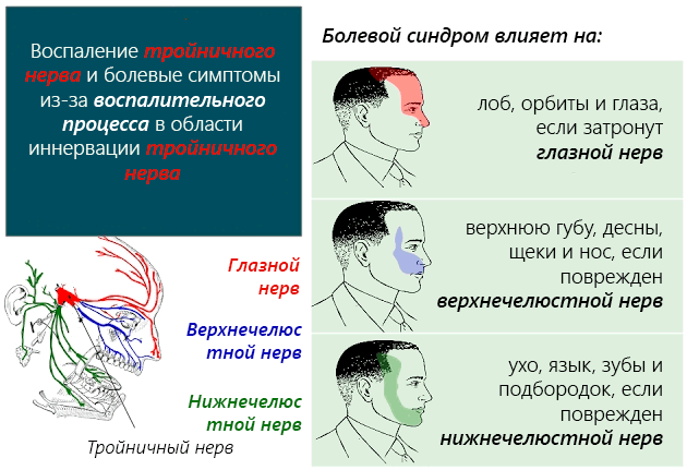 Тройничный нерв – что такое, где находится? воспаление тройничного нерва, невралгия, неврит – симптомы и лечение