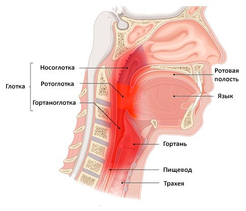 Фарингит: этиология, все формы и симптомы, диагноз, лечение