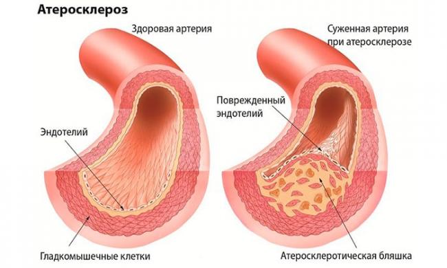 Кардиоактив боярышник инструкция по применению цена отзывы аналоги