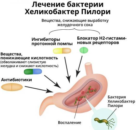 Почему лечение от хеликобактера вредно для здоровья - часть 2