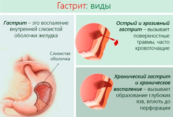 Диета №8 (стол №8): питание при ожирении