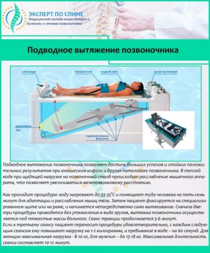 Искривление позвоночника (болезнь шейермана-мау )